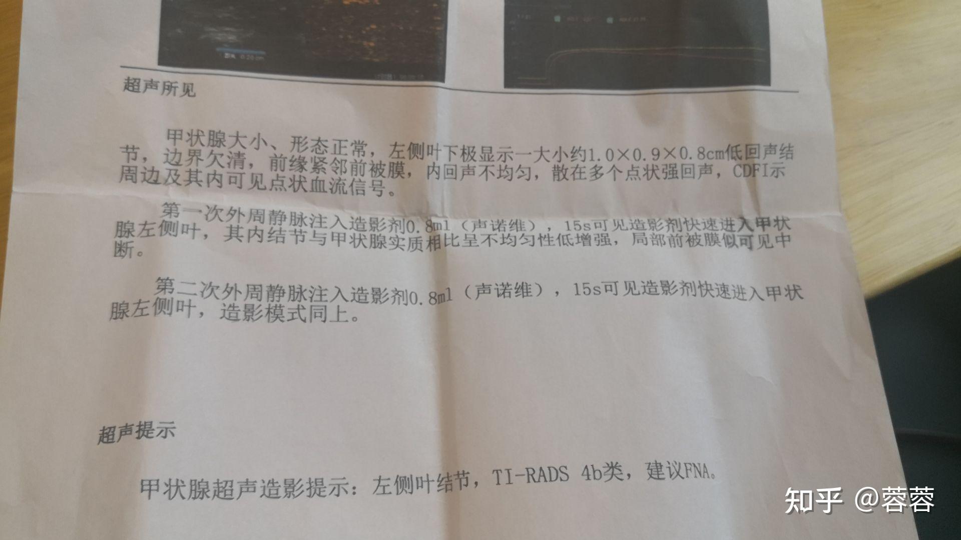 甲状腺贴吧最新动态与小巷深处的甲状腺美食秘境探索